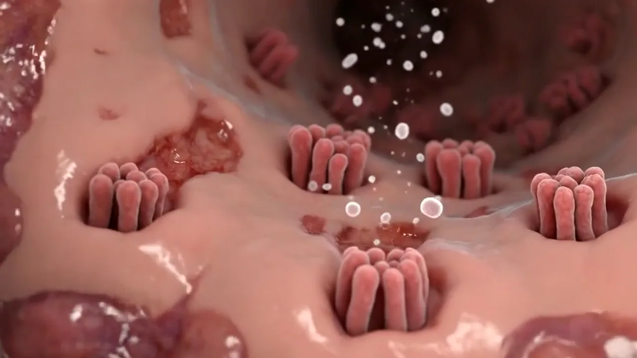 Illustrative animation of an inflamed intestinal lining healing.