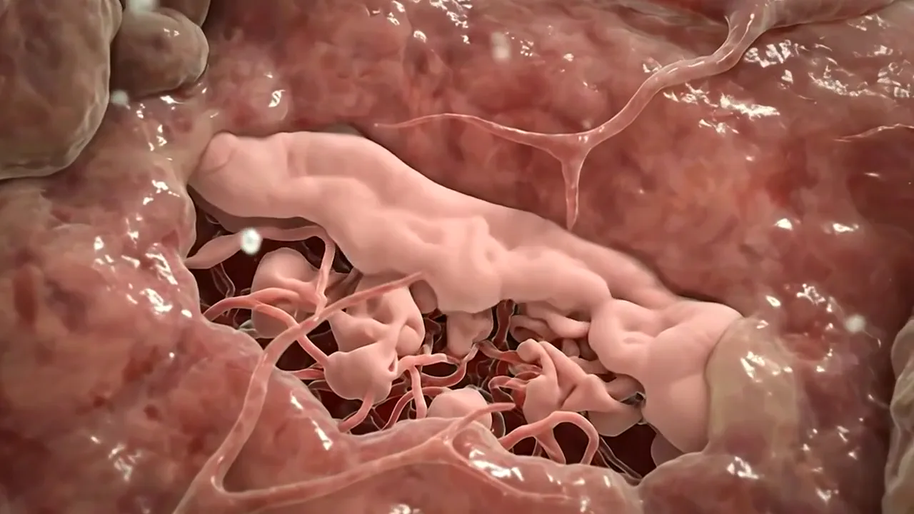 Illustrative animation of immune attacks on tissue settling.