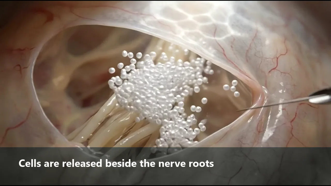 Illustration of cells travelling through clear spinal fluid along the spinal cord.